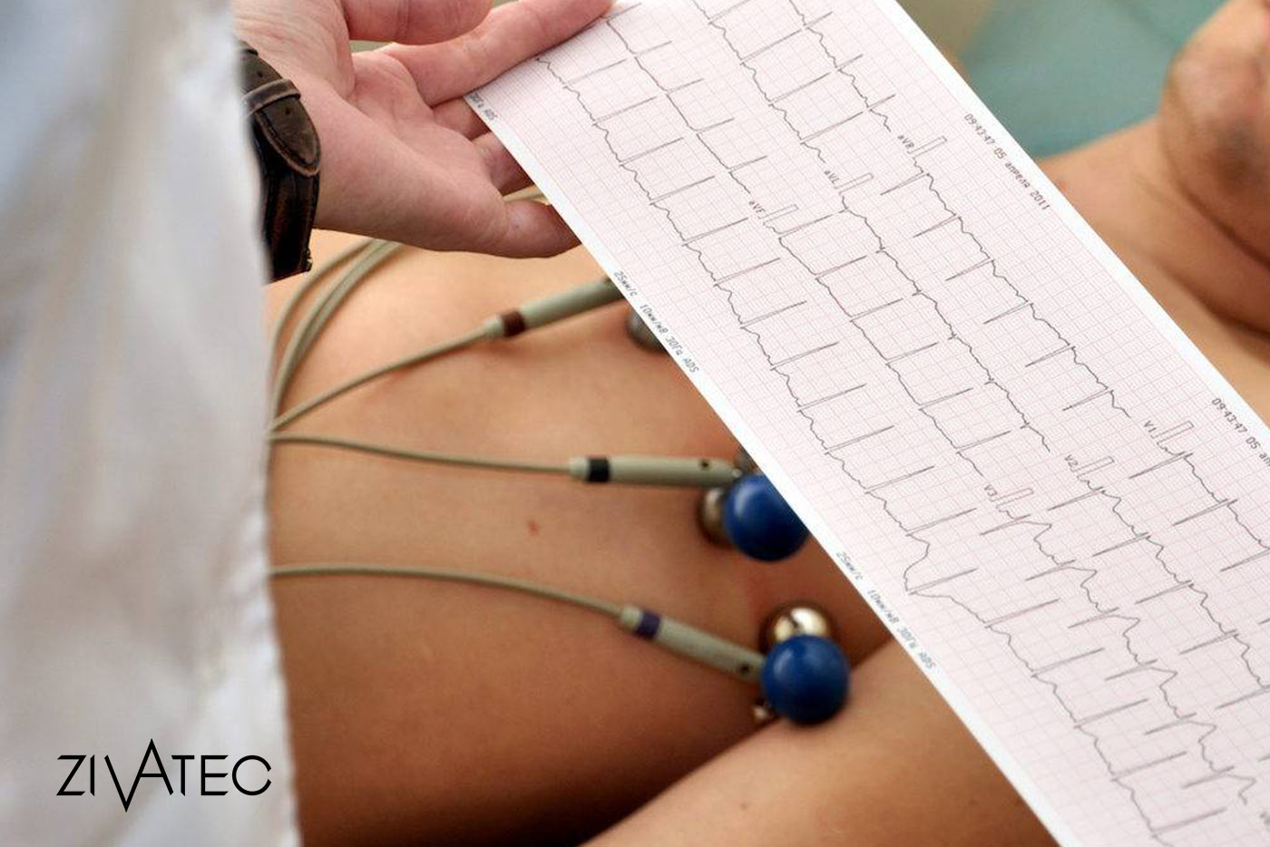 Review and comparison of types of electrocardiogram devices