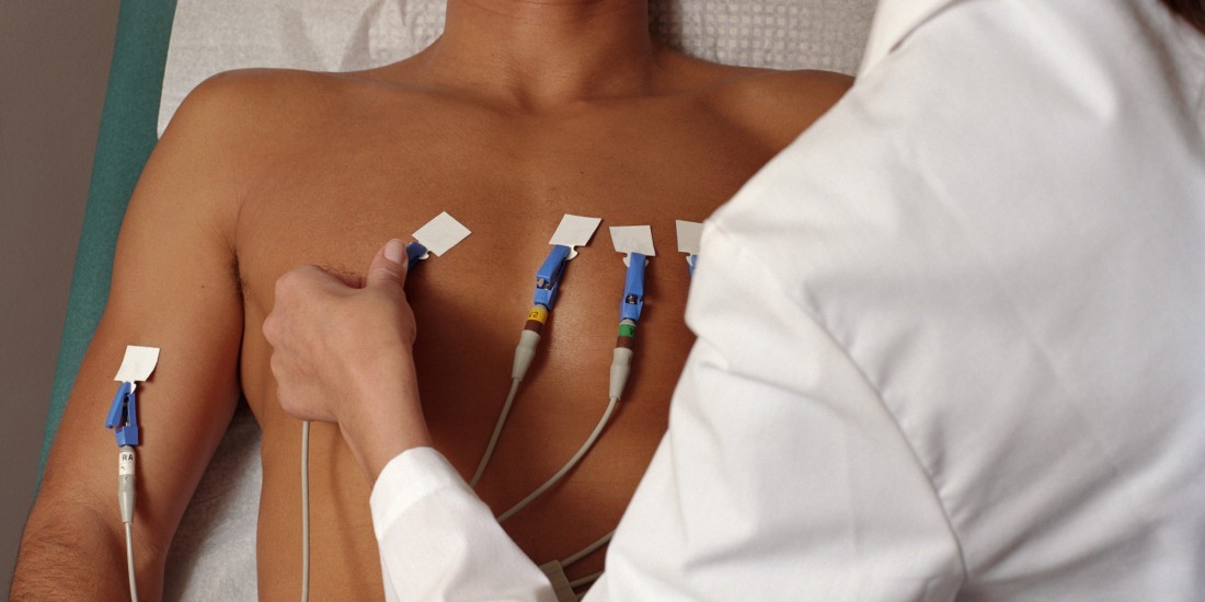 نحوه اتصال لیدهای دستگاه الکتروکاردیوگرام نوار قلب (EKG) روی بدن بیمار