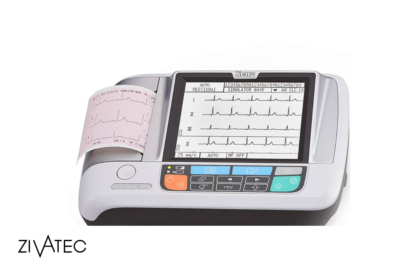 تفسیر نوار قلب (ECG یا EKG) - آموزش مختصر خواندن نوار قلب